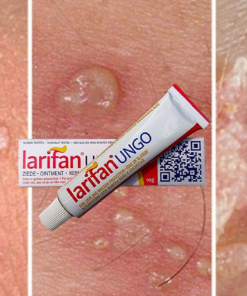 Larifan Ungo 10g – Thuốc bôi điều trị sùi mào gà, herpes sinh dục larifan 1