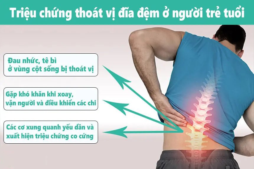 Dấu hiệu thoát vị đĩa đệm ở người trẻ tuổi thoat vi dia dem o nguoi tre tuoi min