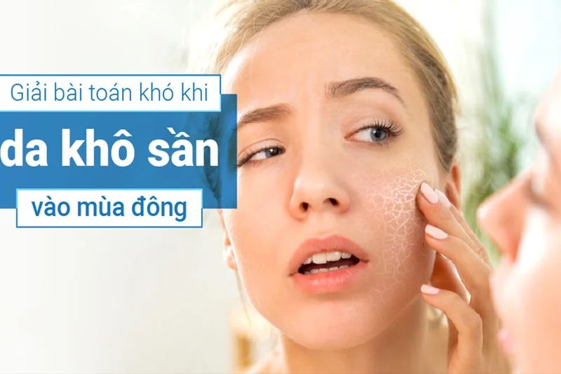 Da khô sần là vấn đề da thường gặp trong mùa đông khi độ ẩm xuống thấp
