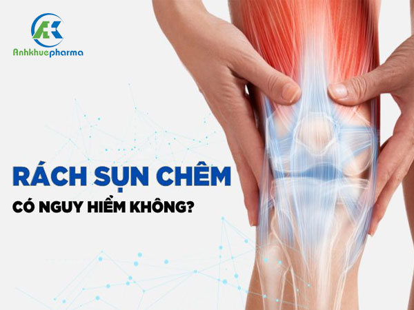 Rách sụn chêm gối là gì? Có nguy hiểm không? Untitled 1 3