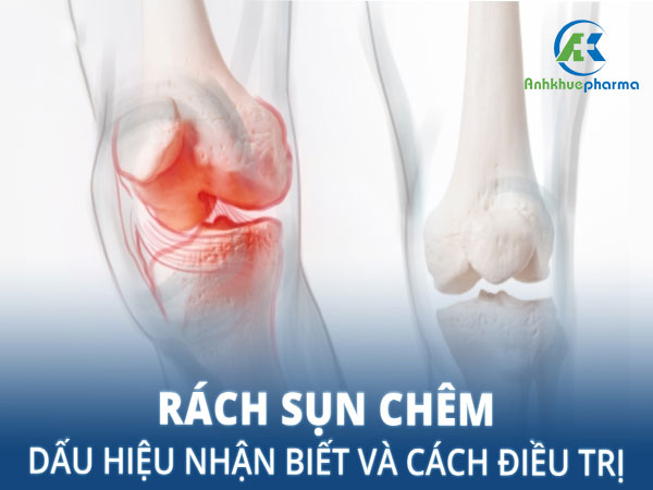 Sau phẫu thuật rách sụn chêm có đá bóng được không? Untitled 1 4