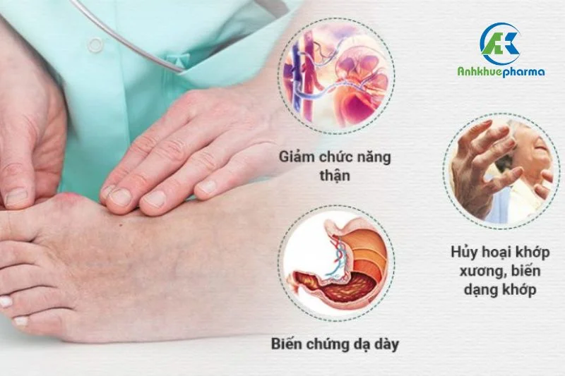 Tại Việt Nam, bệnh gút cũng có xu hướng xuất hiện ở người trẻ tuổi