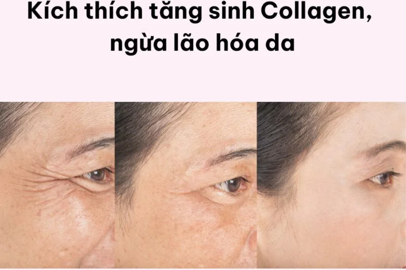 Peptide - Lựa chọn hàng đầu trong điều trị sẹo mụn peptide