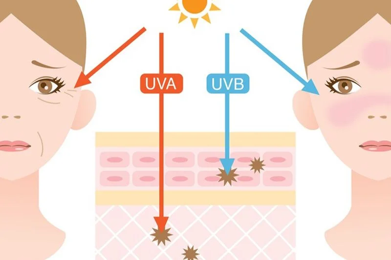 Ánh nắng mặt trời với những tia UV là tác nhân chính gây lão hóa da sớm, nám da, tàn nhang, thậm chí ung thư da