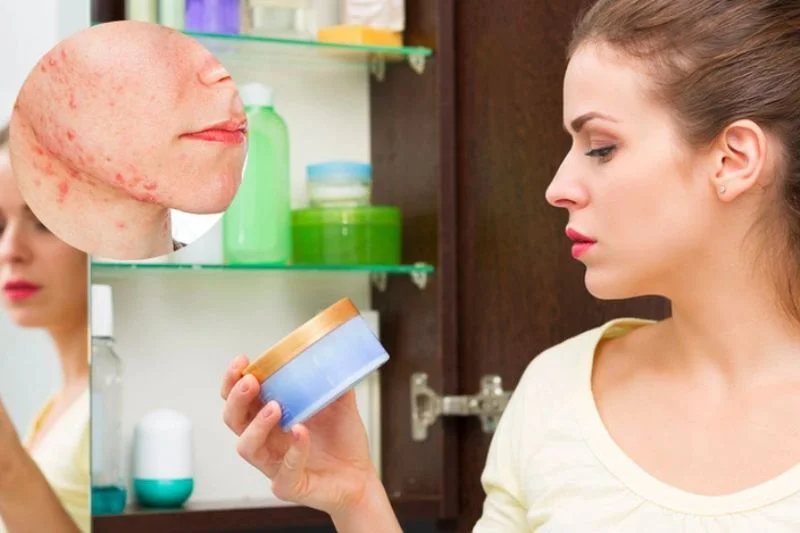 Lạm dụng mỹ phẩm không phù hợp có thể gây tắc nghẽn lỗ chân lông và nổi mụn nước