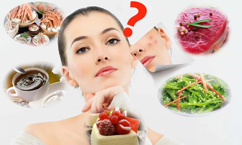Chế độ ăn uống có liên quan mật thiết đến việc hình thành mụn trứng cá trên da