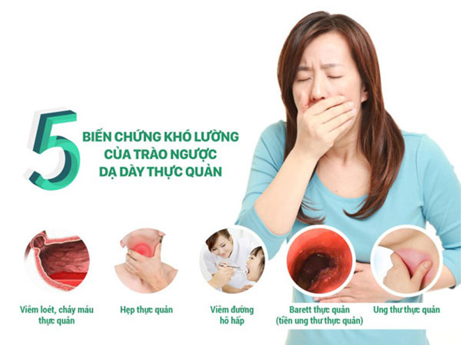 Trào ngược dạ dày, tiêu hóa kém là vấn đề tiêu hóa phổ biến, ảnh hưởng nghiêm trọng đến chất lượng cuộc sống