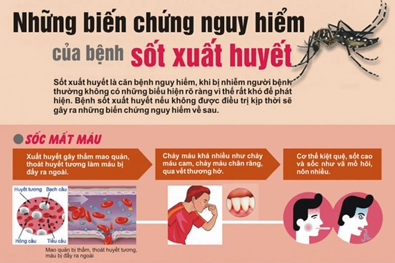 Sốt xuất huyết Dengue không còn theo mùa - Chủ động phòng ngừa ngay hôm nay Chảy máu cam dữ dội, rong kinh, xuất huyết đường tiêu hóa, xuất huyết nội tạng... là những biến chứng nfguy hiểm của sốt xuất huyết Dengue